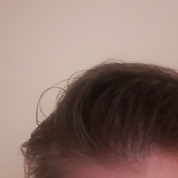 Gliss Şampuan Kepek Ve Kaşıntı