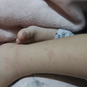 Abdi İbrahim Grintuss Pediatrik Şikayet Var