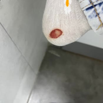 Puma Ayakkabı Yıpranma Ve Yırtılma