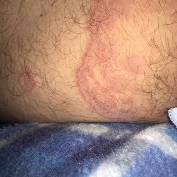 MHRS (Merkezi Hekim Randevu Sistemi) Randevu Bulamıyorum