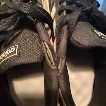 FLO Ayakkabı Adidas Üretici Hatası Ayakkabılarının Arkasında Durmadı