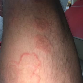 Mersin Şehir Hastanesi Eğitimsiz Egolu Stresli Doktor