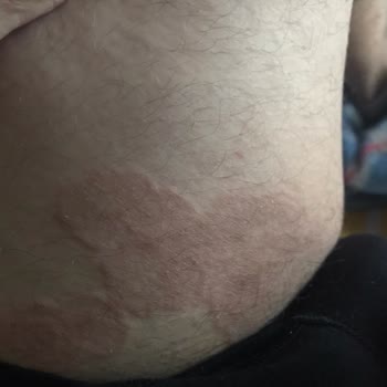 Mersin Şehir Hastanesi Eğitimsiz Egolu Stresli Doktor