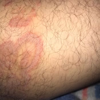Mersin Şehir Hastanesi Eğitimsiz Egolu Stresli Doktor