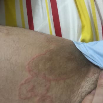 Mersin Şehir Hastanesi Eğitimsiz Egolu Stresli Doktor