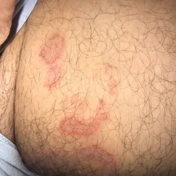 Mersin Şehir Hastanesi Eğitimsiz Egolu Stresli Doktor