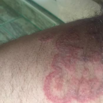 Mersin Şehir Hastanesi Eğitimsiz Egolu Stresli Doktor