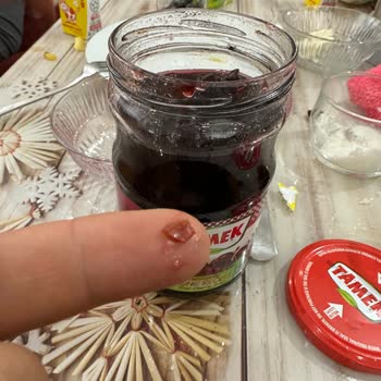 Tamek Vişne Reçelinden Çekirdek Kırıkları Çıkması