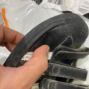 Garantide Küflenen Adidas Ayakkabı.