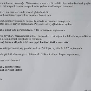 Özel İntertıp Polikliniği Taş Kırma Merkezi