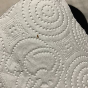 Selpak Kağıt Havluda Ölü Böcek