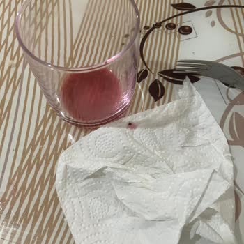 Doğanay Şalgam İçerisinde Sinek Var