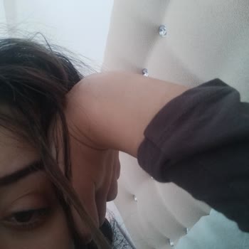 Labella Lens Lens Kullanımında Yaşanan Kalite Ve Uygunluk Problemi