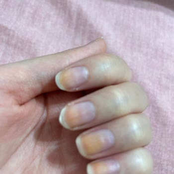 Pastel Kozmetik Oje Sorunu İçin Yardım