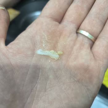 Superfresh Ton Balığından Çıkan Yabancı Cisim