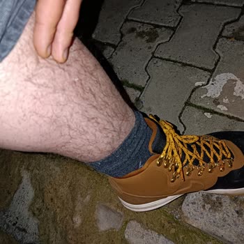 Gebze Belediyesi Köpek Saldırısı