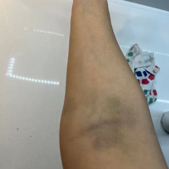 Okan Üniversitesi Hastanesi İnsan Sağlığını Önemsemeyen Hastane