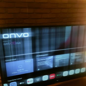 Onvo Dönüş Olmuyor Ne Yazık Ki