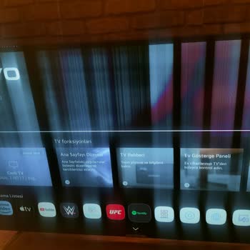 Onvo Dönüş Olmuyor Ne Yazık Ki