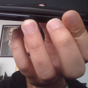 Omix Pil Sorunu Ve Batarya Şişmesi