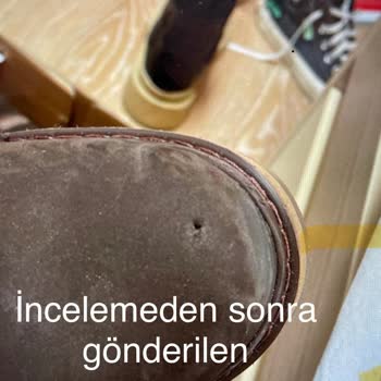 Boyner Botum 3 Saate Deforme Oldu İnceleme Sonrası Daha Kötü!