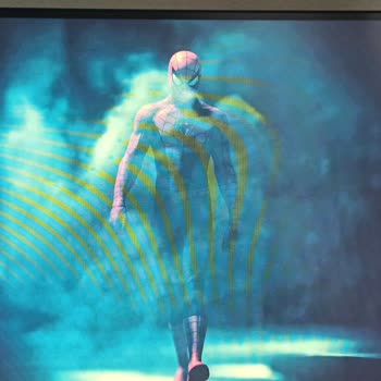 Samsung G3 Monitör Şikayet Var