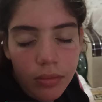 Johnsons Baby Jelin Yüzümdeki İzleri!
