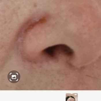 Estheclinica Güzellik Merkezi Esteclinica Güzellik Merkezinde Yapılan İşlem