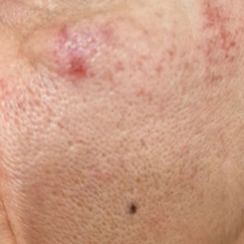 Estheclinica Güzellik Merkezi Esteclinica Güzellik Merkezinde Yapılan İşlem