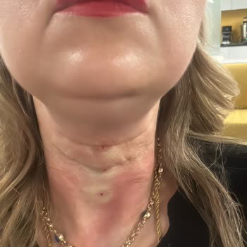 B7 Clinics B7 Clinic Mağduriyeti