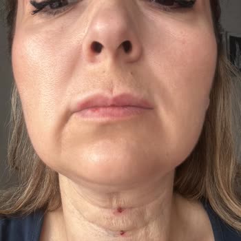 B7 Clinics B7 Clinic Mağduriyeti