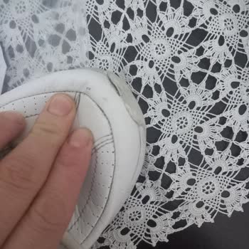 Skechers 20 Günde Deforme Oldu