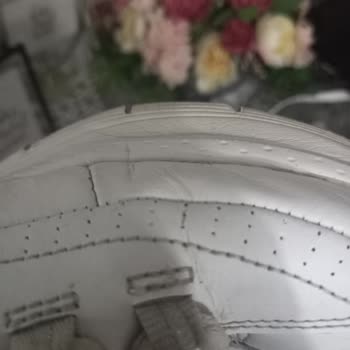 Skechers 20 Günde Deforme Oldu