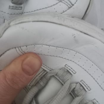Skechers 20 Günde Deforme Oldu