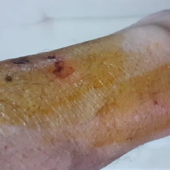 Bornova Belediyesi Sokak Köpeklerine Çözüm Bulmalı