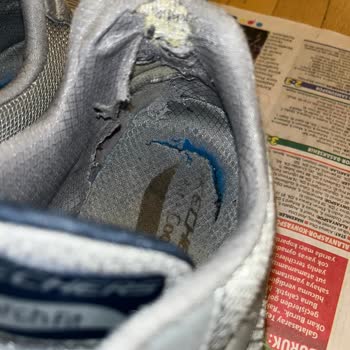 Skechers Spor Ayakkabı Deformasyonu Ve Müşteri Hizmetleri Şikayeti