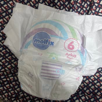 Molfix 6 Cırtlı Bez Sızdırma Yapıyor