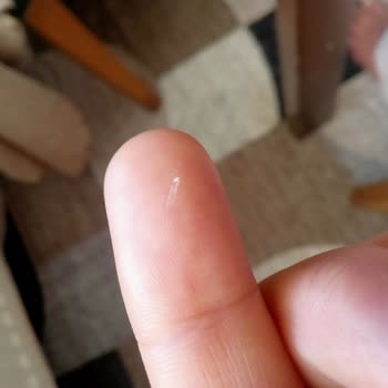 Eti Gıda Bisküvi Paketinde Beklenmedik Yabancı Madde Bulundu