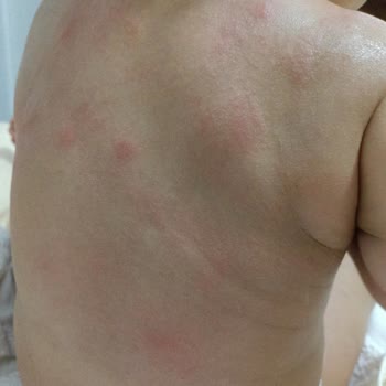 Sleepy 5 Numara Bebek Bezi Alerji