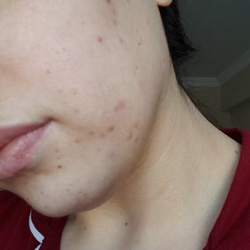 Atomy Kore Ürünleri Kullanım Sonrası Hayal Kırıklığı