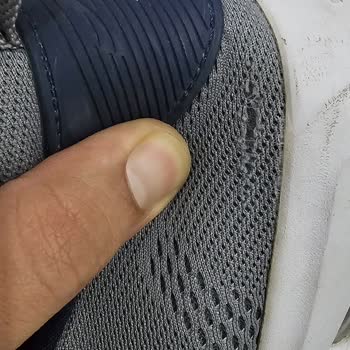 2 Ayda Yıpranan Skechers Ayakkabı Sorunu