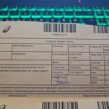 2 Ayda Yıpranan Skechers Ayakkabı Sorunu