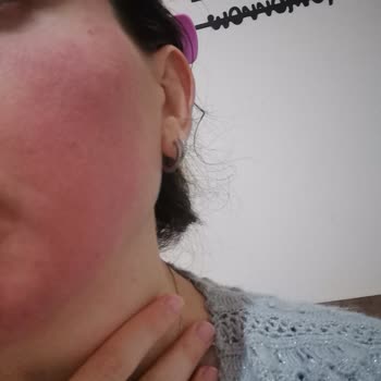 Eyüp Sabri Tuncer Gül Suyu Alerji