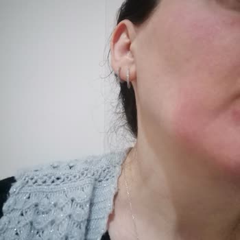 Eyüp Sabri Tuncer Gül Suyu Alerji