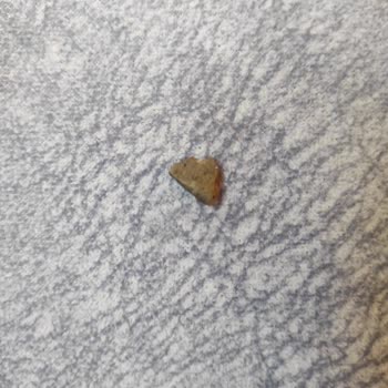 A101 Helvanın İçerisinden Taş Çıktı