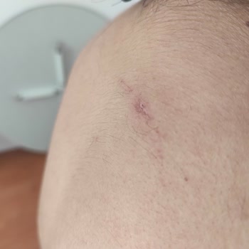 Merray Güzellik (Zeytinburnu) Merray Güzellik Merkezi ( Zeytinburnu) Epilasyon Şikayeti