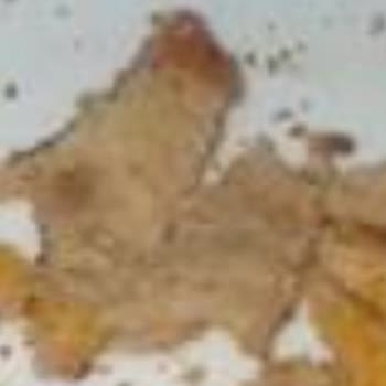 Keskinoğlu Marka Bozuk Sinitzel Ve Chicken Fingers Memnuniyetsizliği