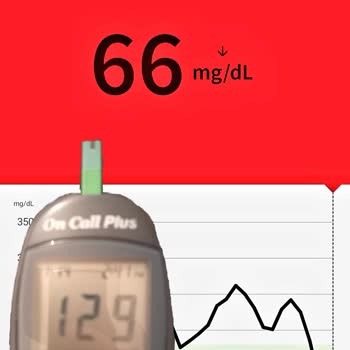 Freestyle Libre Freestyle Ve Parmak Ölçümü Arkasındaki Büyük Fark