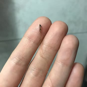 Rossmann Saç Fırçası Saçımda Eridi