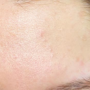 Bioderma Atoderm Krem Komedon Şikayet